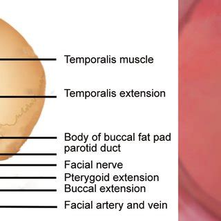 bichats fettpute|Versatility and Importance of Bichat's Fat Pad in .